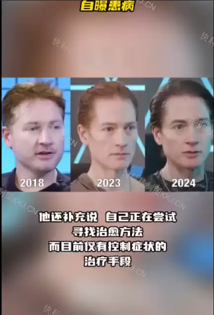 美国换血富豪回应克隆自己:没创造胚胎 只是将实际细胞年龄归为零岁